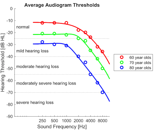 Average Hearing Loss Data